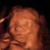 baby